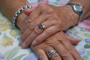 Major Causes Of Skin Aging